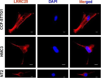 LRRC25 expression during physiological aging and in mouse models of Alzheimer’s disease and iPSC-derived neurons